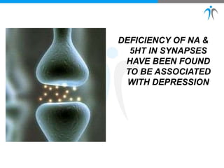 DEFICIENCY OF NA &
5HT IN SYNAPSES
HAVE BEEN FOUND
TO BE ASSOCIATED
WITH DEPRESSION
 