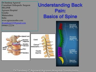 Dr.Sandeep C Agrawal Agrasen Hospital Gondia India
1
Understanding Back
Pain:
Basics of Spine
Dr.Sandeep Agrawal
Consultant Orthopedic Surgeon
MS,DNB
Agrasen Hospital
Gondia
Maharashtra
India
www.agrasenortho.com
drsandeep123@gmail.com
09960122234
 