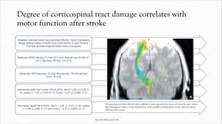Degree of corticospinal tract damage correlates with
motor function after stroke
Didapatkan bukti ada korelasi yang kuat antara Difussion Tensor Tractography
dengan National Institute of Health Stroke Scale (NIHSS) & Upper Extremity
Fugl Myer terhadap derajat kerusakan traktus corticospinal
Rerata skor NIHSS fase akut (3-7 hari):10.7 (±5.5), fase sub akut (30 hari): 6.1
(±5.7), fase kronis (90 hari) : 4.8 (±4.6)
Rerata skor UEFM fase akut : 25 (±22), fase sub akut : 39 (±24) dan fase
kronis : 45 (±23)
Nilai korelasi positif Fiber number (FNr) & UEFM : akut (r = 0.50, p= 0.032, n=
18), subakut (r = 0.57, p= 0.007,n= 21), kronik (r = 0.67, p= 0.0008, n= 21)
Nilai korelasi negatif FNr & NIHSS : akut (r = -0.48, p= 0.043, n= 18), subakut
(r = -0.58, p= 0.006, n= 21), and kronik (r = -0.75, p = 0.0001, n= 21)
Demonstration of the affected and unaffected corticospinal tracts from a 67-year-old man with a
left hemispheric infarct in the distribution of the middle cerebral artery, at the subacute phase
(30 days after onset)
doi: 10.1002/acn3.132
 