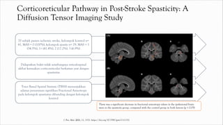 Corticoreticular Pathway in Post-Stroke Spasticity: A
Diffusion Tensor Imaging Study
70 subjek pasien ischemic stroke, kelompok kontrol n=
41, MAS = 0 (100%), kelompok spastis n= 29, MAS = 1
(34.5%), 1+ (41.4%), 2 (17.2%), 3 (6.9%)
Didapatkan bukti tidak seimbangnya reticulospinal
akibat kerusakan corticoreticular berkaitan erat dengan
spastisitas
Tract Based Spatial Statistic (TBSS) menunjukkan
adanya penurunan signifikan Fractional Anisotropy
pada kelompok spastisitas dibanding dengan kelompok
kontrol
There was a significant decrease in fractional anisotropy values in the ipsilesional brain
stem in the spasticity group, compared with the control group in both lesions (p < 0.05)
J. Pers. Med. 2021, 11, 1151. https://doi.org/10.3390/jpm11111151
 