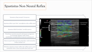 Spastisitas Non Neural Reflex
Spastisitas terbagi menjadi 2 komponen
Spastisitas akibat neural reflex/ meningkatnya arkus refleks spinal
Spastisitas akibat kontraktur/ non-reflex spasticity
Pemeriksaan spastisitas (asworth scale) ataupun penggunaan
electromyograph sekalipun tidak mampu
membedakan/mengidentifikasi komponen spastisitas tsb
Elastosonografi ultrasound sering digunakan untuk memeriksa
struktur jaringan otot
Perbedaan elastisitas jaringan terlihat dari indikasi warna, warna
merah-lebih elastis, warna biru-tidak elastis (stiff tissue)
 