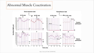 Abnormal Muscle Coactivation
https://doi.org/10.1186/1743-0003-8-41
 