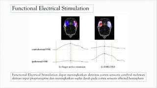 Functional Electrical Stimulation
Functional Electrical Stimulation dapat meningkatkan aktivitas cortex sensoris cerebral melewati
aktivasi input proprioceptive dan meningkatkan suplai darah pada cortex sensoris affected hemisphere
 