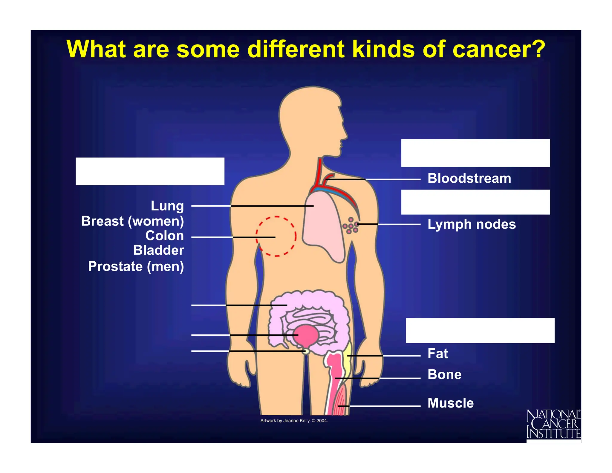 Basics of cancer and its types and its prevention | PDF