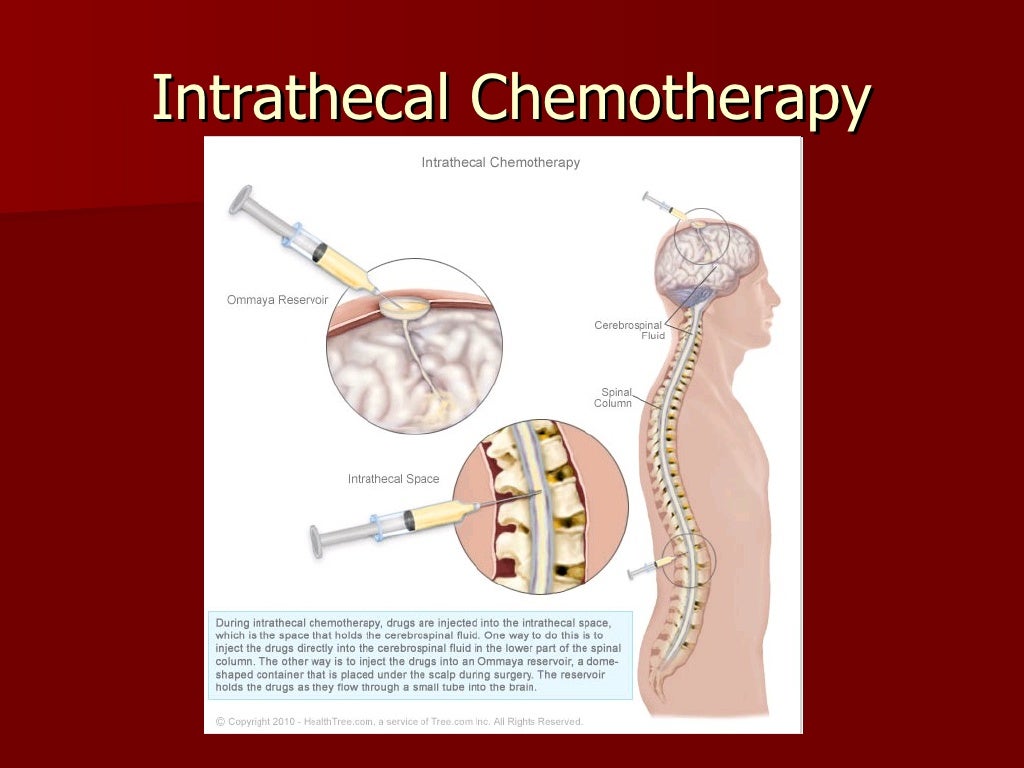 Understanding chemotherapy