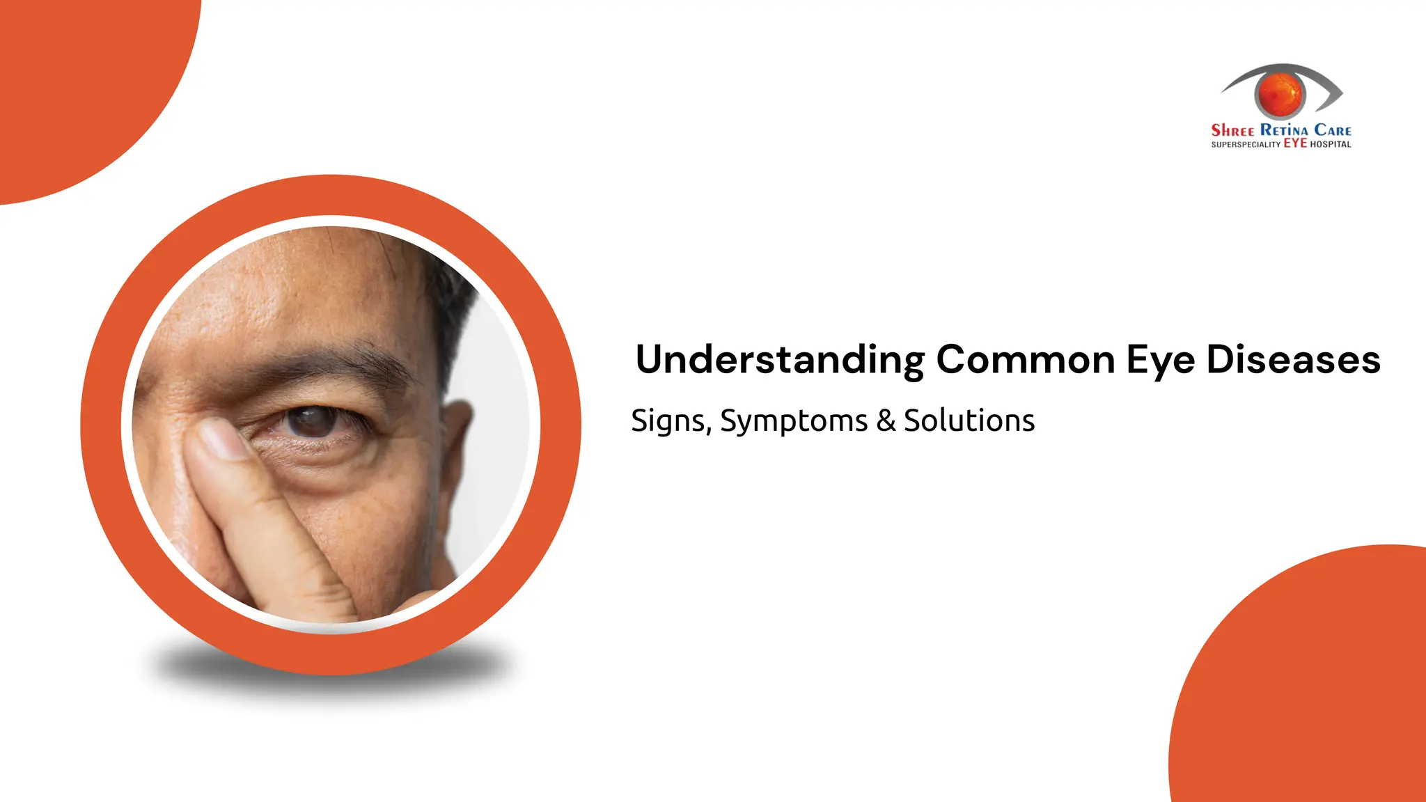 Understanding Common Eye Diseases Signs, Symptoms & Solution.pdf