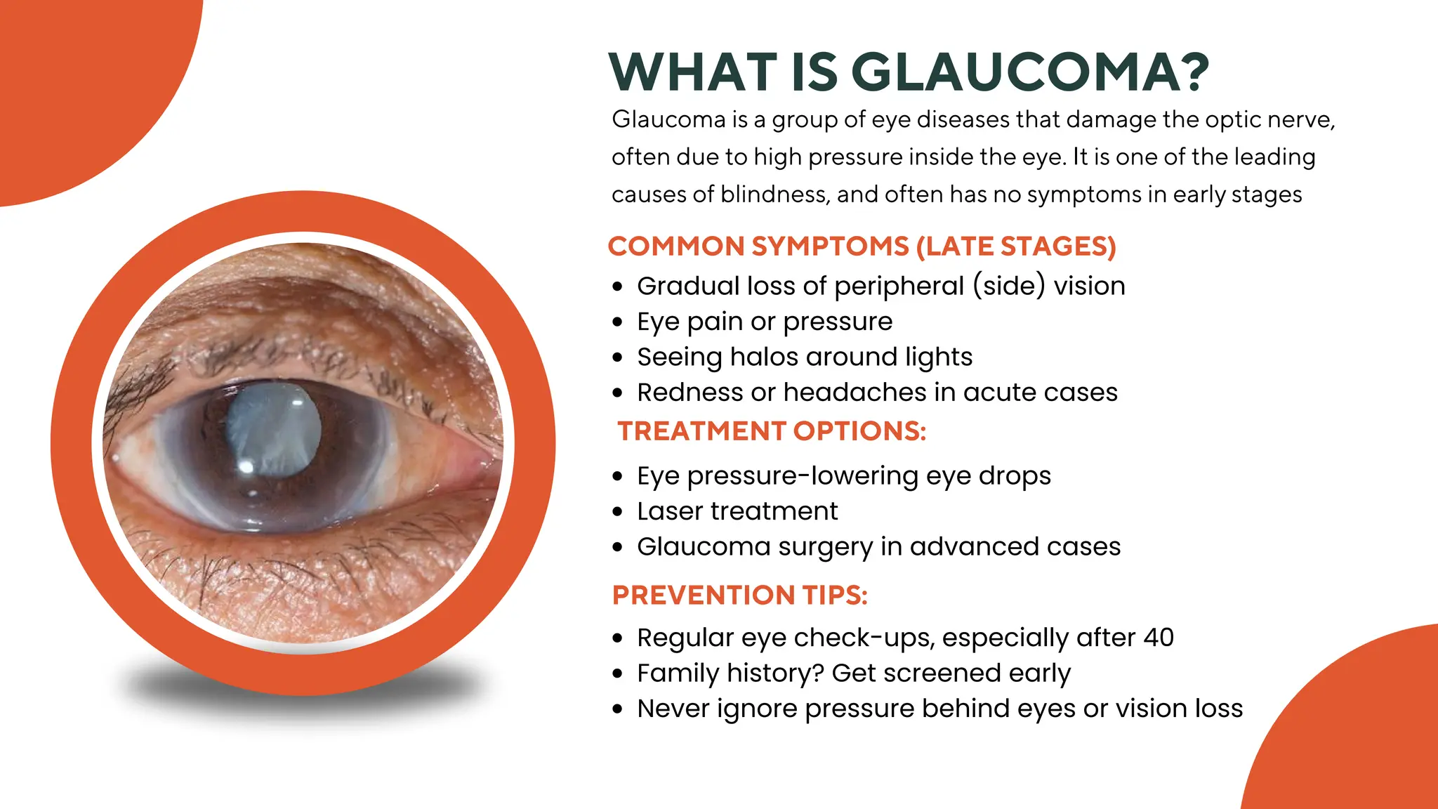 Understanding Common Eye Diseases Signs, Symptoms & Solution.pdf