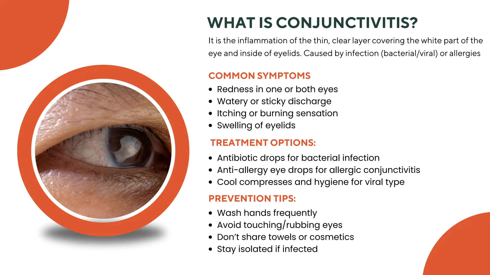 Understanding Common Eye Diseases Signs, Symptoms & Solution.pdf