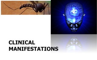 CLINICAL
MANIFESTATIONS
 