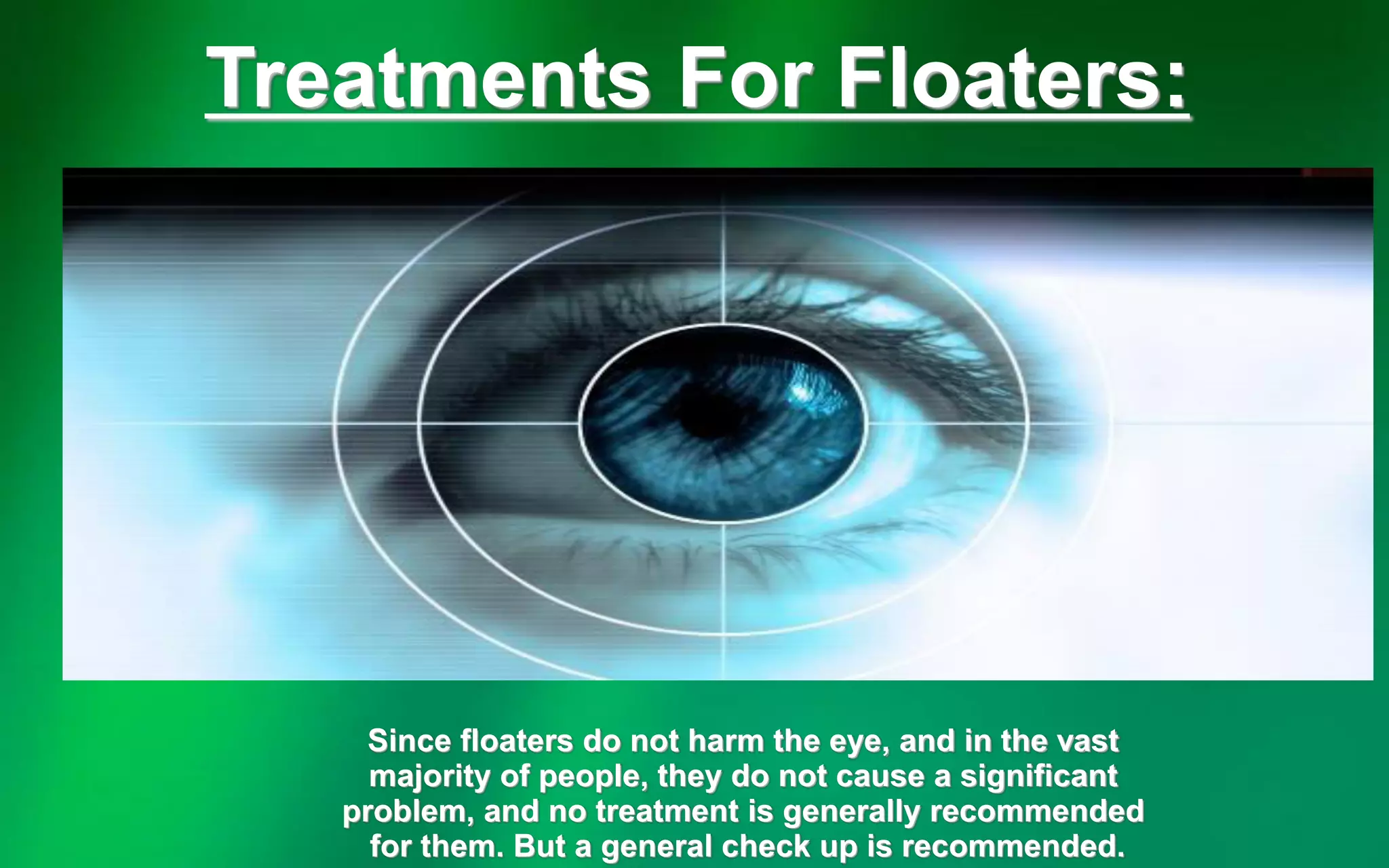 Understanding eye floaters | PDF