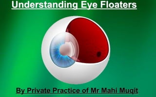 Understanding Eye Floaters
By Private Practice of Mr Mahi Muqit
 