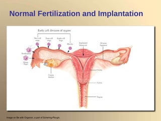 Normal Fertilization and Implantation Image on file with Organon, a part of Schering-Plough. 
