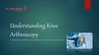 Understanding Knee
Arthroscopy
A MINIMALLY INVASIVE APPROACH TO KNEE HEALTH
 