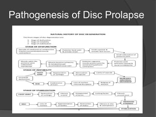 Disc Prolapse Classification Understanding lumbar disc herniation | PPT