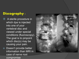 Discography Injection Understanding lumbar disc herniation | PPT