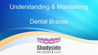 Understanding & Maintaining
Dental Braces
 