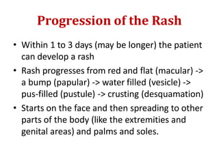 Progression of the Rash
• Within 1 to 3 days (may be longer) the patient
can develop a rash
• Rash progresses from red and flat (macular) ->
a bump (papular) -> water filled (vesicle) ->
pus-filled (pustule) -> crusting (desquamation)
• Starts on the face and then spreading to other
parts of the body (like the extremities and
genital areas) and palms and soles.
 