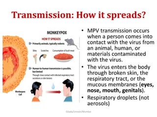 Transmission: How it spreads?
• MPV transmission occurs
when a person comes into
contact with the virus from
an animal, human, or
materials contaminated
with the virus.
• The virus enters the body
through broken skin, the
respiratory tract, or the
mucous membranes (eyes,
nose, mouth, genitals).
• Respiratory droplets (not
aerosols)
Gilada/Unison/Mumbai
 