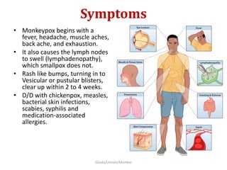 Symptoms
• Monkeypox begins with a
fever, headache, muscle aches,
back ache, and exhaustion.
• It also causes the lymph nodes
to swell (lymphadenopathy),
which smallpox does not.
• Rash like bumps, turning in to
Vesicular or pustular blisters,
clear up within 2 to 4 weeks.
• D/D with chickenpox, measles,
bacterial skin infections,
scabies, syphilis and
medication-associated
allergies.
Gilada/Unison/Mumbai
 