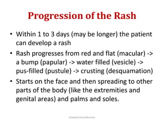 Progression of the Rash
• Within 1 to 3 days (may be longer) the patient
can develop a rash
• Rash progresses from red and flat (macular) ->
a bump (papular) -> water filled (vesicle) ->
pus-filled (pustule) -> crusting (desquamation)
• Starts on the face and then spreading to other
parts of the body (like the extremities and
genital areas) and palms and soles.
Gilada/Unison/Mumbai
 