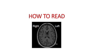 HOW TO READ
 