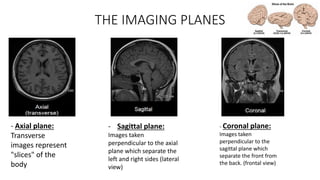 THE IMAGING PLANES
- Axial plane:
Transverse
images represent
"slices" of the
body
- Sagittal plane:
Images taken
perpendicular to the axial
plane which separate the
left and right sides (lateral
view)
- Coronal plane:
Images taken
perpendicular to the
sagittal plane which
separate the front from
the back. (frontal view)
 