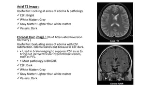 Axial T2 image :
Useful for: Looking at areas of edema & pathology
CSF: Bright
White Matter: Gray
Gray Matter: Lighter than white matter
Vessels: Dark
Coronal Flair image : (Fluid Attenuated Inversion
Recovery )
Useful for: Evaluating areas of edema with CSF
subtraction. Edema stands out because is CSF dark.
• • Used in brain imaging to suppress CSF so as to
bring out periventricular hyperintense lesions,
such as PVL.
• • Most pathology is BRIGHT.
CSF: Dark
White Matter: Gray
Gray Matter: Lighter than white matter
Vessels: Dark
 