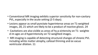 • Conventional MR imaging exhibits superior sensitivity for non-cavitary
PVL, especially in the acute setting (2-5 days).
• Lesions appear as small punctate hyperintense areas on T1-weighted
images, 20, 21 which are likely to be a product of reactive gliosis. 24
• Cavitations are also visible as areas of hy p ointensity on T1- weighte
d im ages an d hyperintensity on T2-weighted images.
• MR imaging is capable of detecting structural changes of chronic PVL
including white matter atrophy, callosal thinning and ex vacuo
ventricular dilation. 11
 
