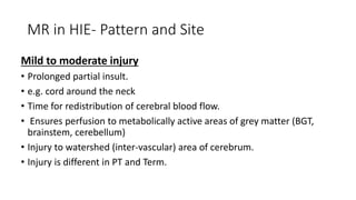 MR in HIE- Pattern and Site
Mild to moderate injury
• Prolonged partial insult.
• e.g. cord around the neck
• Time for redistribution of cerebral blood flow.
• Ensures perfusion to metabolically active areas of grey matter (BGT,
brainstem, cerebellum)
• Injury to watershed (inter-vascular) area of cerebrum.
• Injury is different in PT and Term.
 
