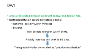 DWI
• Areas of restricted diffusion are bright on DWI and dark on ADC.
• Restricted diffusion occurs in cytotoxic edema:
– Ischemia (possibly within minutes)
– Seizures
DWI detects infarction within 24hrs.
Rapidly increases and peak at 3-5 days.
Then gradually fades away called as “pseudonormalization”
 