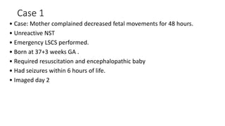 Case 1
• Case: Mother complained decreased fetal movements for 48 hours.
• Unreactive NST
• Emergency LSCS performed.
• Born at 37+3 weeks GA .
• Required resuscitation and encephalopathic baby
• Had seizures within 6 hours of life.
• Imaged day 2
 