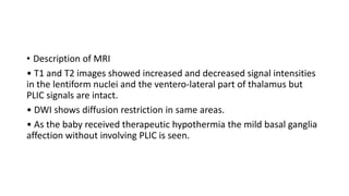 • Description of MRI
• T1 and T2 images showed increased and decreased signal intensities
in the lentiform nuclei and the ventero-lateral part of thalamus but
PLIC signals are intact.
• DWI shows diffusion restriction in same areas.
• As the baby received therapeutic hypothermia the mild basal ganglia
affection without involving PLIC is seen.
 