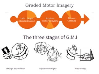 Graded Motor Imagery
 