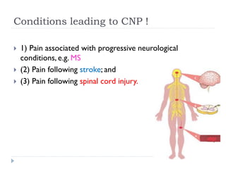 Conditions leading to CNP !
 1) Pain associated with progressive neurological
conditions, e.g. MS
 (2) Pain following stroke; and
 (3) Pain following spinal cord injury.
 