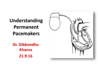 Understanding
Permanent
Pacemakers
Dr. Dibbendhu
Khanra
21.9.16
 