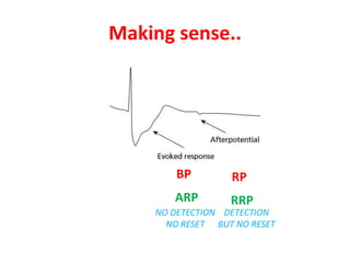 Understanding pacemakers | PPTX