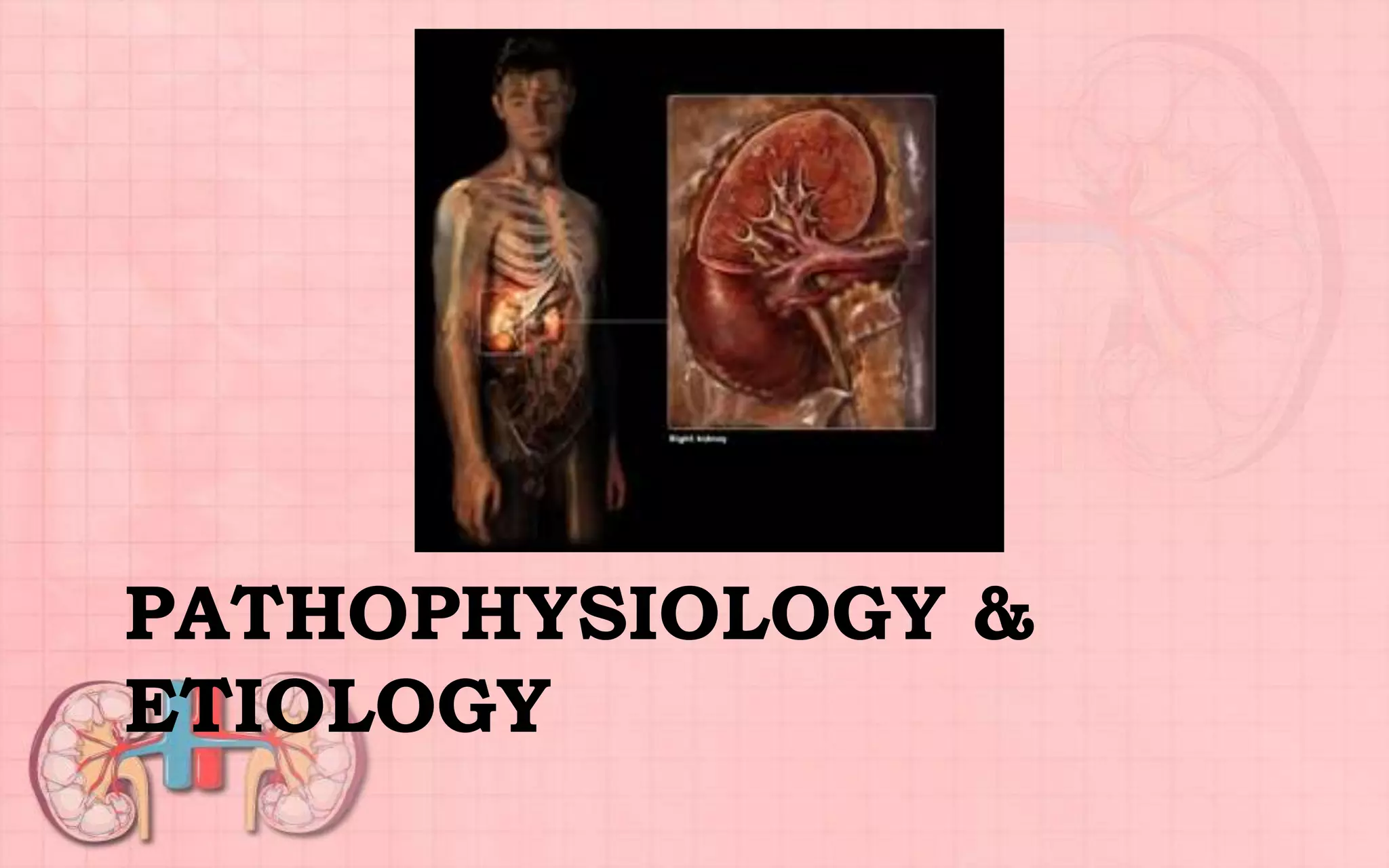 PATHOPHYSIOLOGY &
ETIOLOGY
 