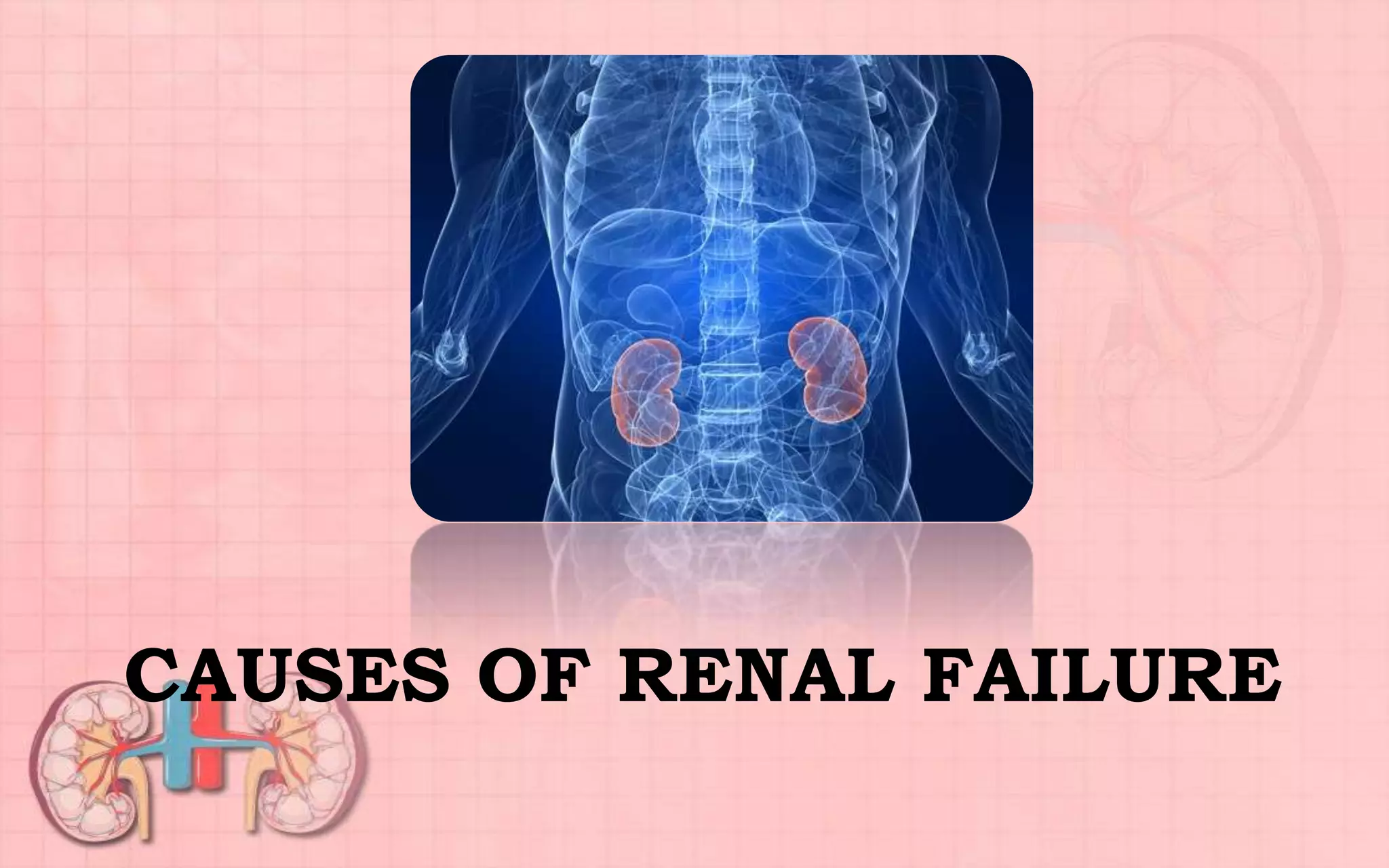 CAUSES OF RENAL FAILURE
 