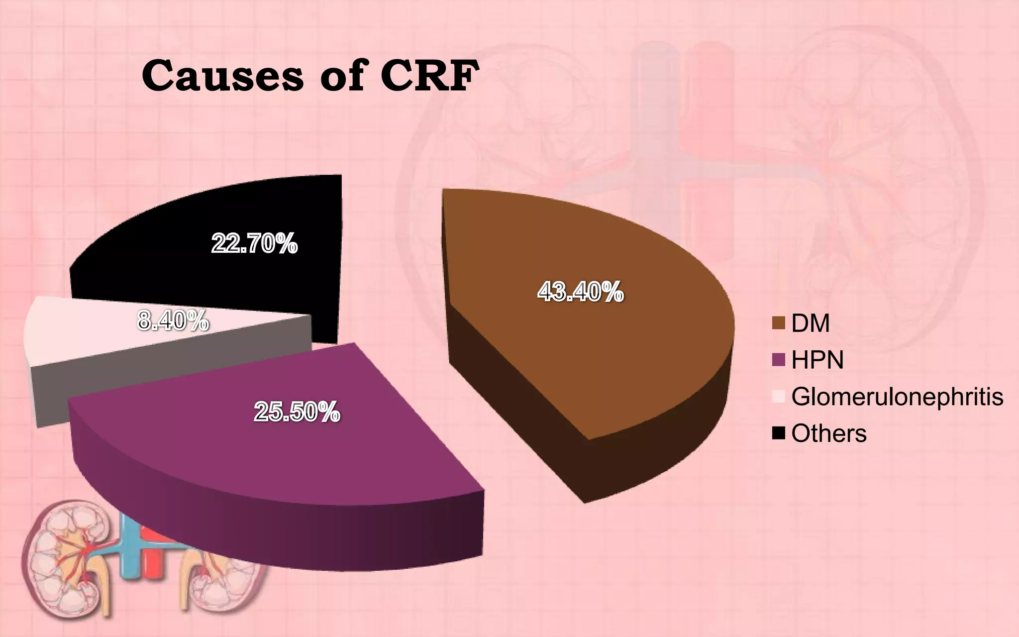 Causes of CRF
DM
HPN
Glomerulonephritis
Others
 