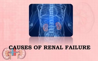 CAUSES OF RENAL FAILURE
 