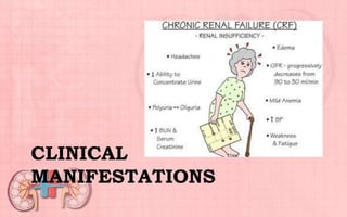 CLINICAL
MANIFESTATIONS
 