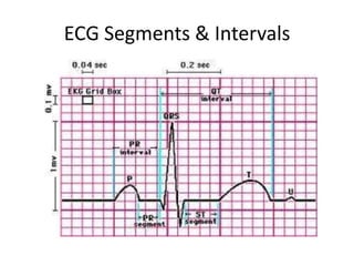 ECG Segments & Intervals
 