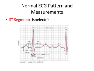 Normal ECG Pattern and
           Measurements
• ST Segment: Isoelectric
 