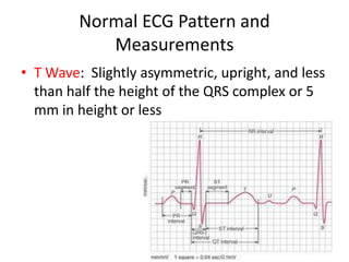 Normal ECG Pattern and
            Measurements
• T Wave: Slightly asymmetric, upright, and less
  than half the height of the QRS complex or 5
  mm in height or less
 
