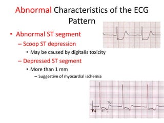 Abnormal Characteristics of the ECG
             Pattern
• Abnormal ST segment
  – Scoop ST depression
    • May be caused by digitalis toxicity
  – Depressed ST segment
    • More than 1 mm
       – Suggestive of myocardial ischemia
 