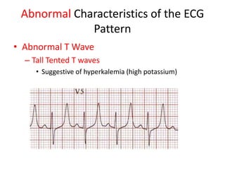 Abnormal Characteristics of the ECG
             Pattern
• Abnormal T Wave
  – Tall Tented T waves
     • Suggestive of hyperkalemia (high potassium)
 