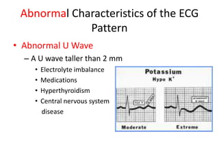 Abnormal Characteristics of the ECG
             Pattern
• Abnormal U Wave
  – A U wave taller than 2 mm
     •   Electrolyte imbalance
     •   Medications
     •   Hyperthyroidism
     •   Central nervous system
         disease
 
