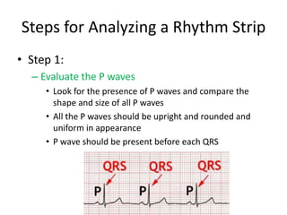 Steps for Analyzing a Rhythm Strip
• Step 1:
  – Evaluate the P waves
     • Look for the presence of P waves and compare the
       shape and size of all P waves
     • All the P waves should be upright and rounded and
       uniform in appearance
     • P wave should be present before each QRS
 
