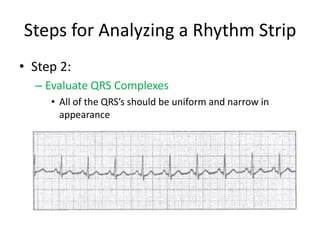 Steps for Analyzing a Rhythm Strip
• Step 2:
  – Evaluate QRS Complexes
     • All of the QRS’s should be uniform and narrow in
       appearance
 