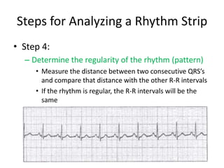 Steps for Analyzing a Rhythm Strip
• Step 4:
  – Determine the regularity of the rhythm (pattern)
     • Measure the distance between two consecutive QRS’s
       and compare that distance with the other R-R intervals
     • If the rhythm is regular, the R-R intervals will be the
       same
 